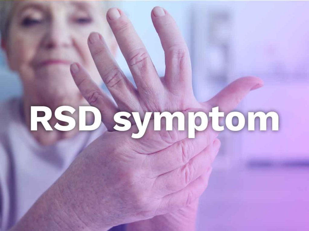 rsd symptoms
